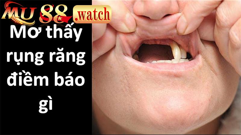 Ý nghĩa quan trọng trong cuộc sống khi nằm mơ thấy rụng răng